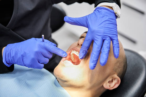 Best Emergency Dental Care for Broken or Chipped Teeth in Conrad, IA